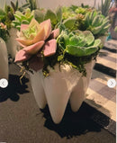 Dental Vase, Tooth Vase, Dental Planter, Tooth Planter, Dentist Gift, Dental Plant, Tooth Plant, Dental Succulent, Dental Appreciation