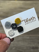 Glitter Molar Stud Earrings: Hypoallergenic Dental Jewelry Gift