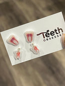 Nerve and Root Canal Earrings