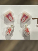 Nerve and Root Canal Earrings