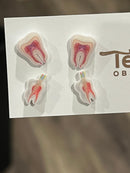 Nerve and Root Canal Earrings