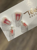 Nerve and Root Canal Earrings
