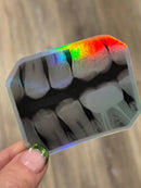 Dental Bitewing Sticker