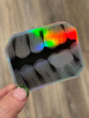 Dental Bitewing Sticker