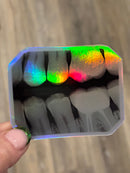Dental Bitewing Sticker