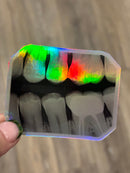 Dental Bitewing Sticker