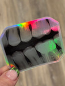 Dental Bitewing Sticker