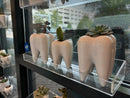 Molar Vases (Medium and Large)