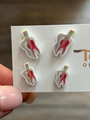 Root Canal Earrings with Guttaa