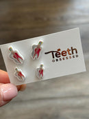 Root Canal Earrings with Guttaa