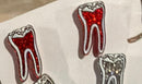RCT Dental Earrings, Endo Teeth Earrings, Tooth Earrings, Glitter Tooth Earrings, Dental Hygiene Gift Dental Assistant